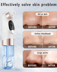 Blackhead Remover Pore Vacuum Face Cleaner